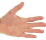 A kéz hámló, száraz és repedezett bőrének okai és kezelése